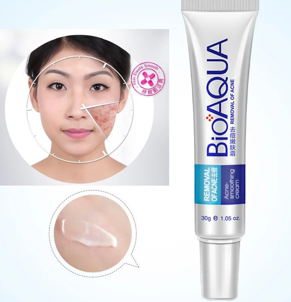 BIOAQUA Anti Acne Cream Acne Scar Removal Cream